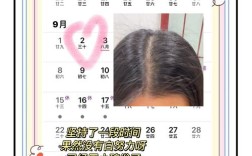 脱发严重是什么原因引起的／20多岁脱发严重是什么原因引起的